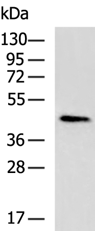 CCN1