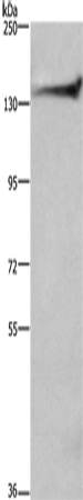 DCTN1