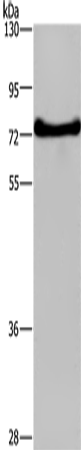 DDX43