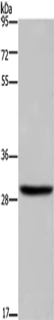 DHRS3