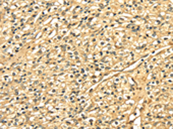 DNASE1