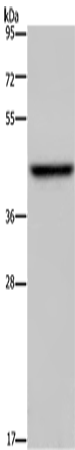 ENTPD5