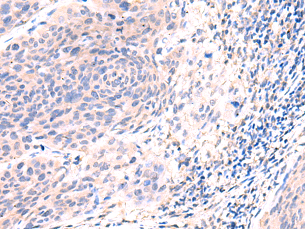 ESM1
