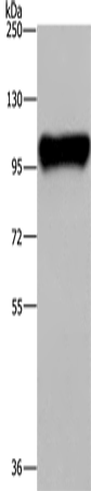PTK2B