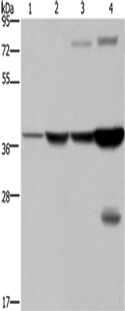 FBP1