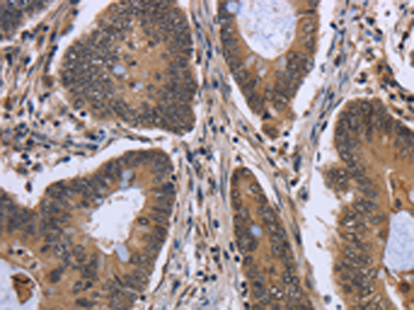 FGFRL1