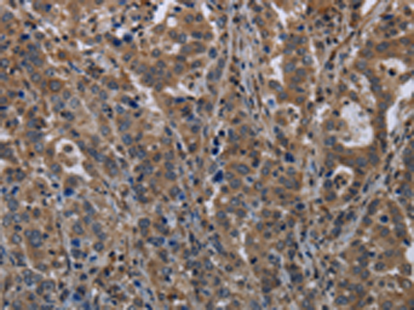 Rabbit Polyclonal Antibody to TSC22D3