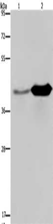 GLUL