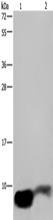 GNG2