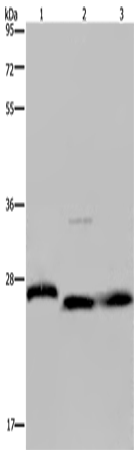 GSTP1
