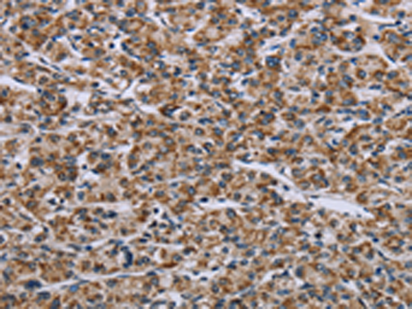 GTPBP10