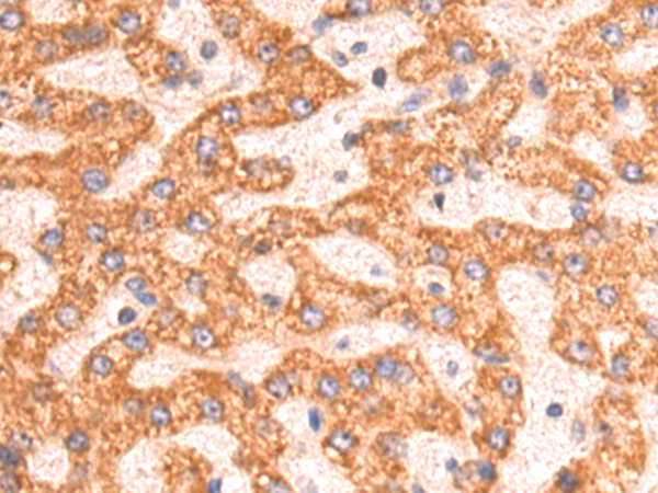 Rabbit Polyclonal Antibody to HMGCL