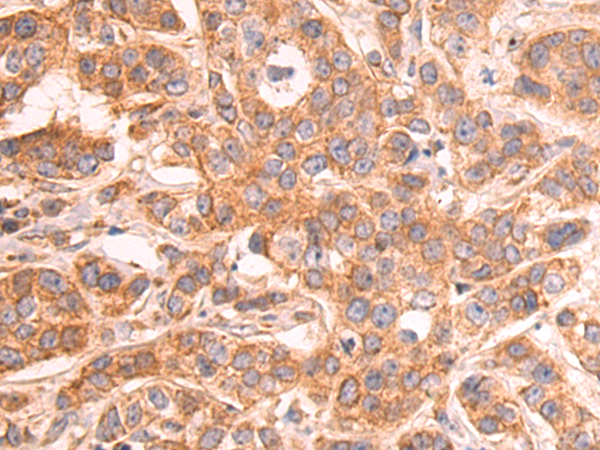Rabbit Polyclonal Antibody to HMGCL