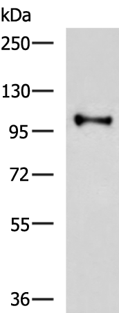 HMGCR
