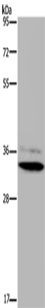 HSD17B7