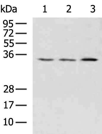 HSD17B13