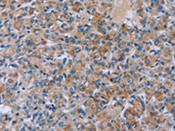 HSD3B2