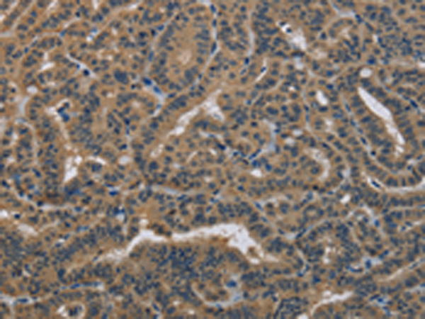 Rabbit Polyclonal Antibody to DNAJA1
