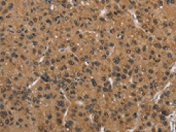 Rabbit Polyclonal Antibody to DNAJA1
