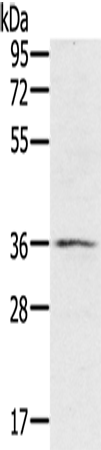 RNF144B