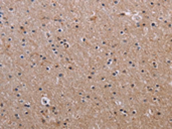 Rabbit Polyclonal Antibody to FCGR3A