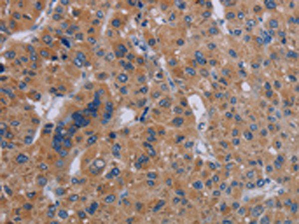 Rabbit Polyclonal Antibody to IL27RA