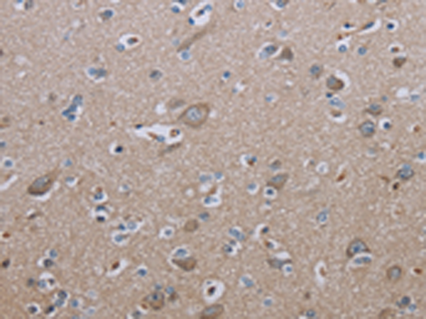 Rabbit Polyclonal Antibody to IL27RA