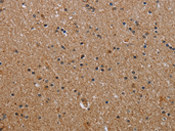 Rabbit Polyclonal Antibody to IL2RG
