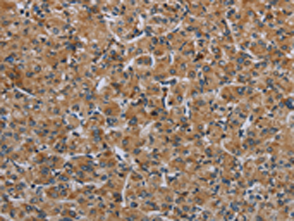 Rabbit Polyclonal Antibody to IL31RA