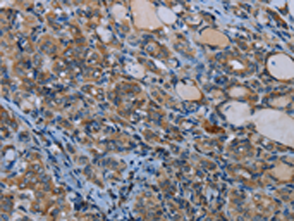 Rabbit Polyclonal Antibody to IL31RA