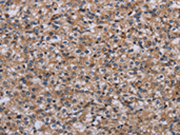 Rabbit Polyclonal Antibody to IPO4
