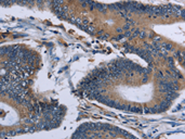 Rabbit Polyclonal Antibody to IPO4