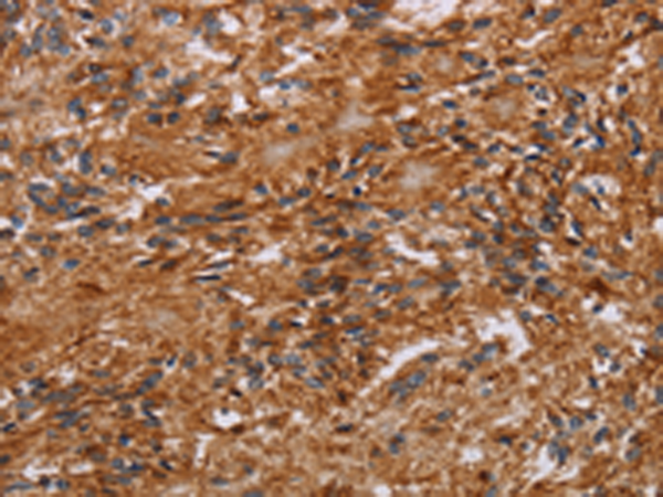 JAKMIP2