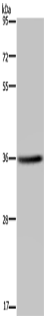 KCNK17