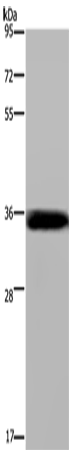 LIMS1