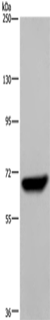 LCP1