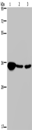 LZTFL1