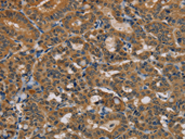 Rabbit Polyclonal Antibody to TAB3