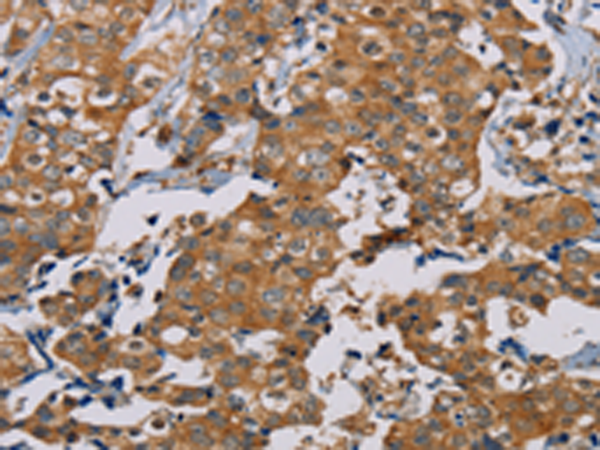 Rabbit Polyclonal Antibody to TAB3
