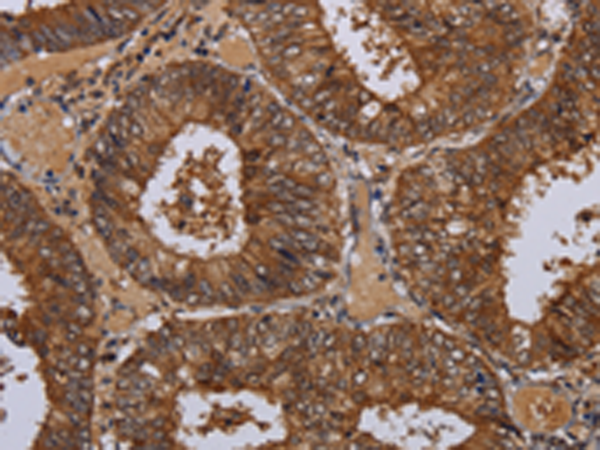 Rabbit Polyclonal Antibody to WDR83