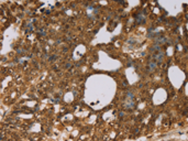 Rabbit Polyclonal Antibody to PSMC2