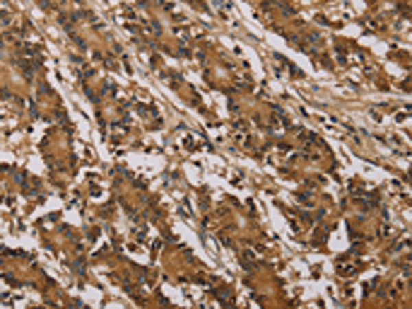 Rabbit Polyclonal Antibody to PSMC2