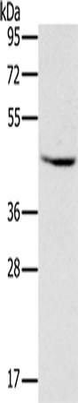 MVK