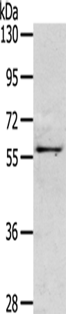 OLFM3