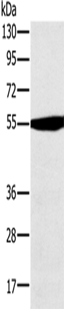 OXCT1