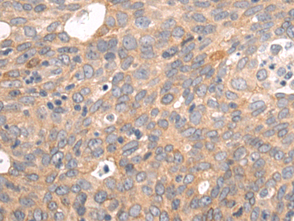 EGLN1