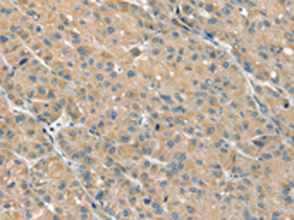 PHLPP1