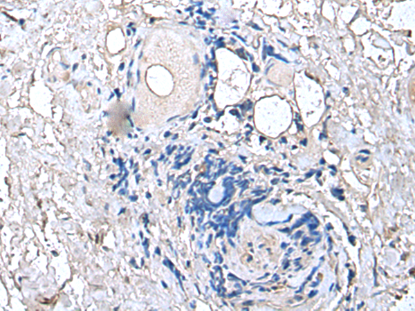 PTP4A1
