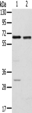 RBBP5
