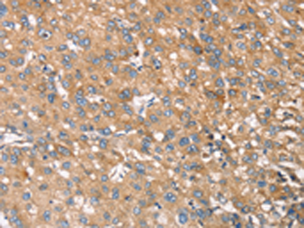 RNASET2